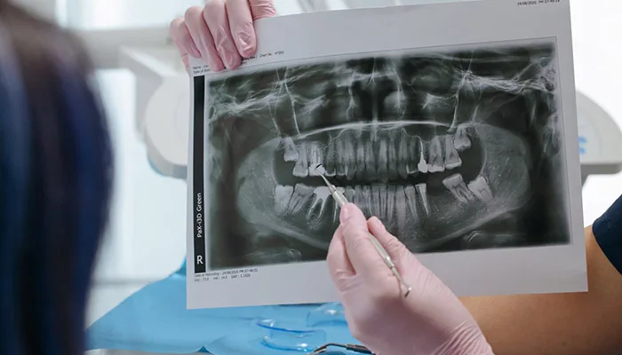 Odontóloga revisando una radiografía dental